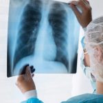 टीबी के उपचार के लिए केंद्र सरकार ने नई दवा को दी मंजूरी