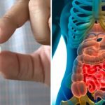 भारत की मशहूर आयुर्वेदिक गोली खाने से व्यक्ति की हालत नाजुक