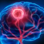 शोधकर्ताओं ने ढूंढा कैंसर का कारण बनने वाला जीन म्यूटेशन