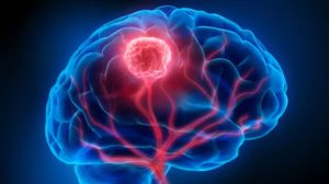 शोधकर्ताओं ने ढूंढा कैंसर का कारण बनने वाला जीन म्यूटेशन