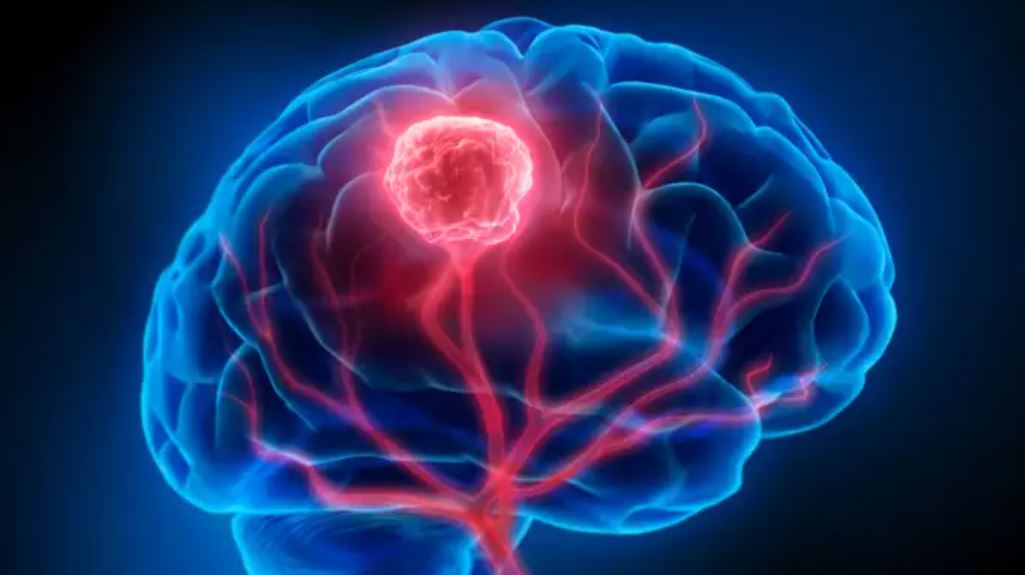 शोधकर्ताओं ने ढूंढा कैंसर का कारण बनने वाला जीन म्यूटेशन