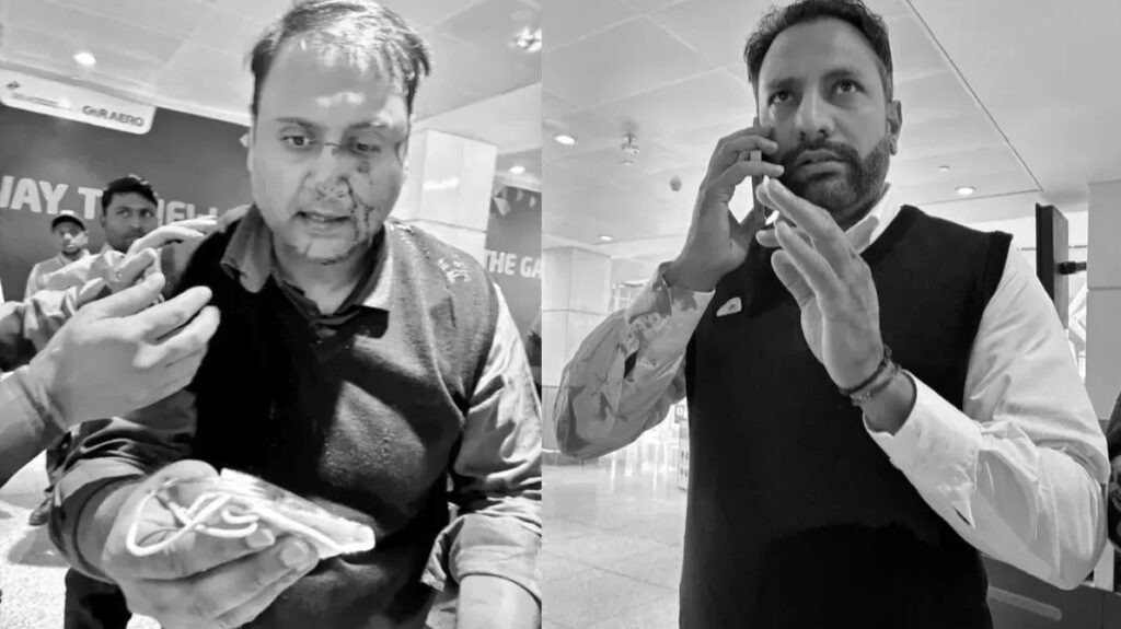 IGI एयरपोर्ट पायलट-यात्री झड़प में FIR, जांच शुरू