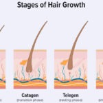 Normal Hair Fall daily