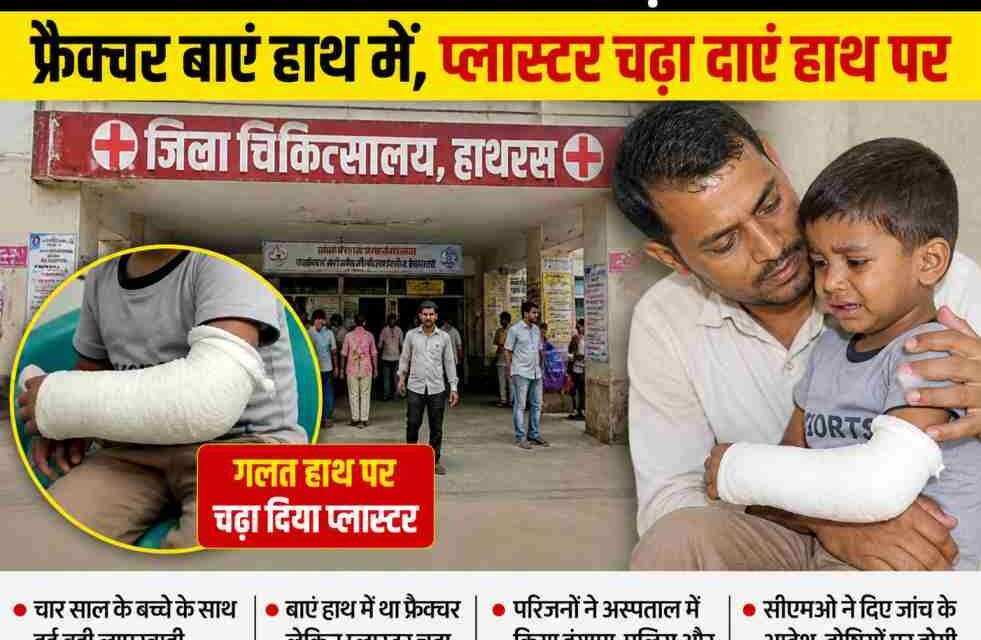 जिला अस्पताल हाथरस में इलाज के दौरान डॉक्टर की लापरवाही से बच्चे के सही हाथ की जगह गलत हाथ पर प्लास्टर किया गया